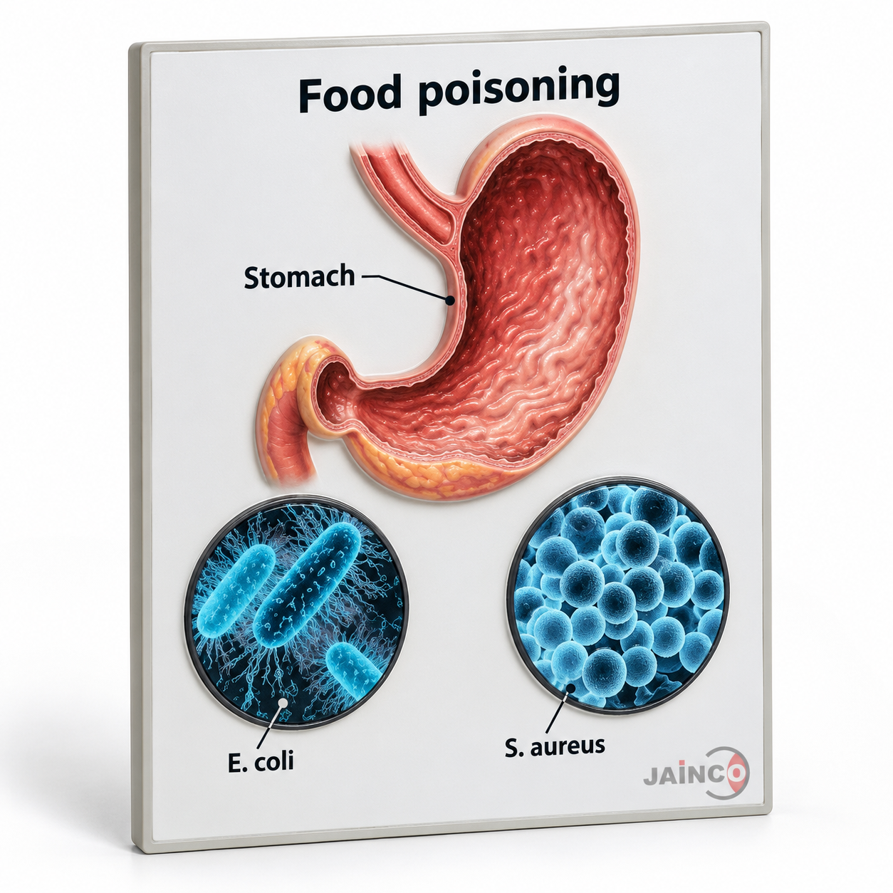 Food Poisoning Model